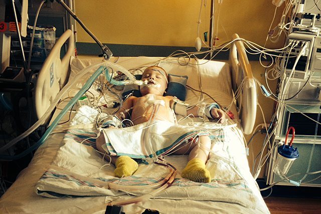 Amazing Patient Jack Foley at two and a half years old, after his third open-heart surgery