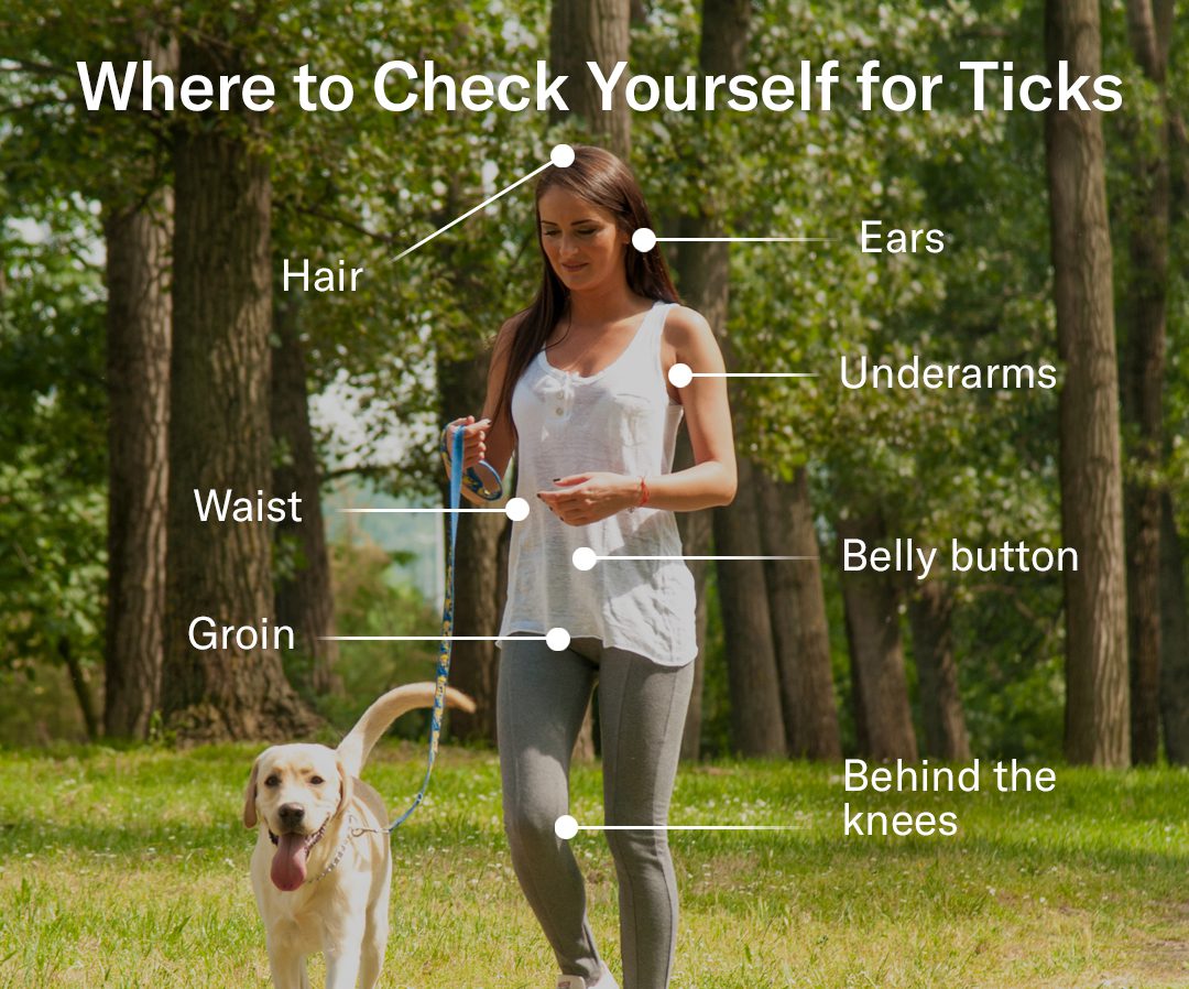 prevent tick bites by checking in these areas for ticks