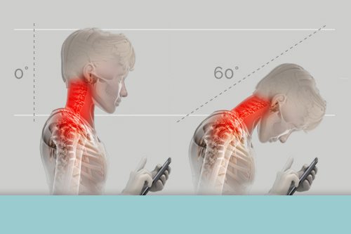 Tips to prevent ‘tech neck’ and other pain from technology use