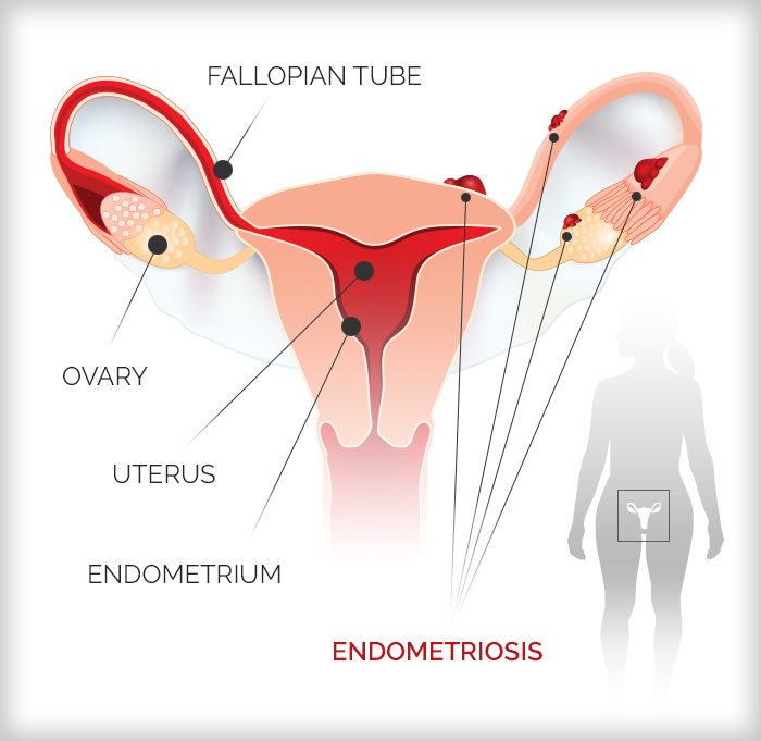 Infographic illustrating the female reproductive system