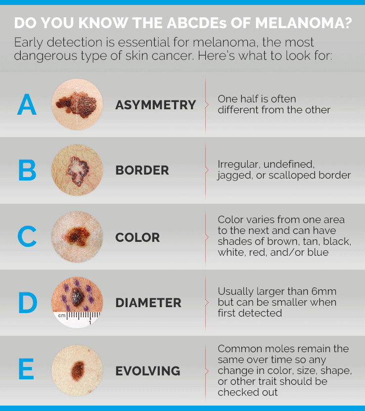 Infographic depicting different moles