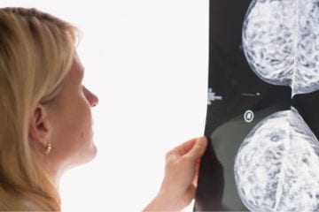 woman looks at scan of lymph nodes after COVID-19 vaccine