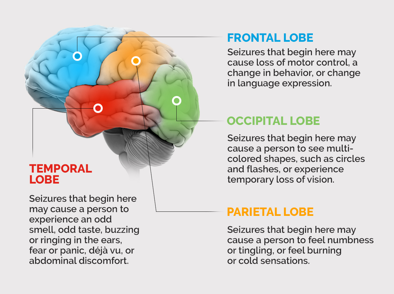 A brain with the different lobes in different colors and text explaining the seizure symptoms you might experience