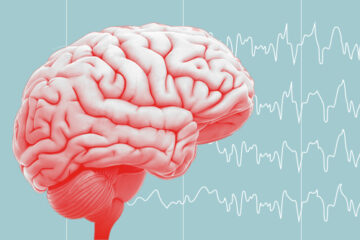 An illustration of a brain sits in front of EEG lines to indicate epilepsy.