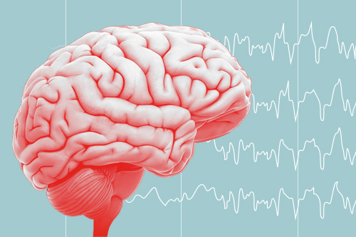 What To Know About Epilepsy