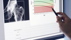 When Should I Get a Bone Density Test?
