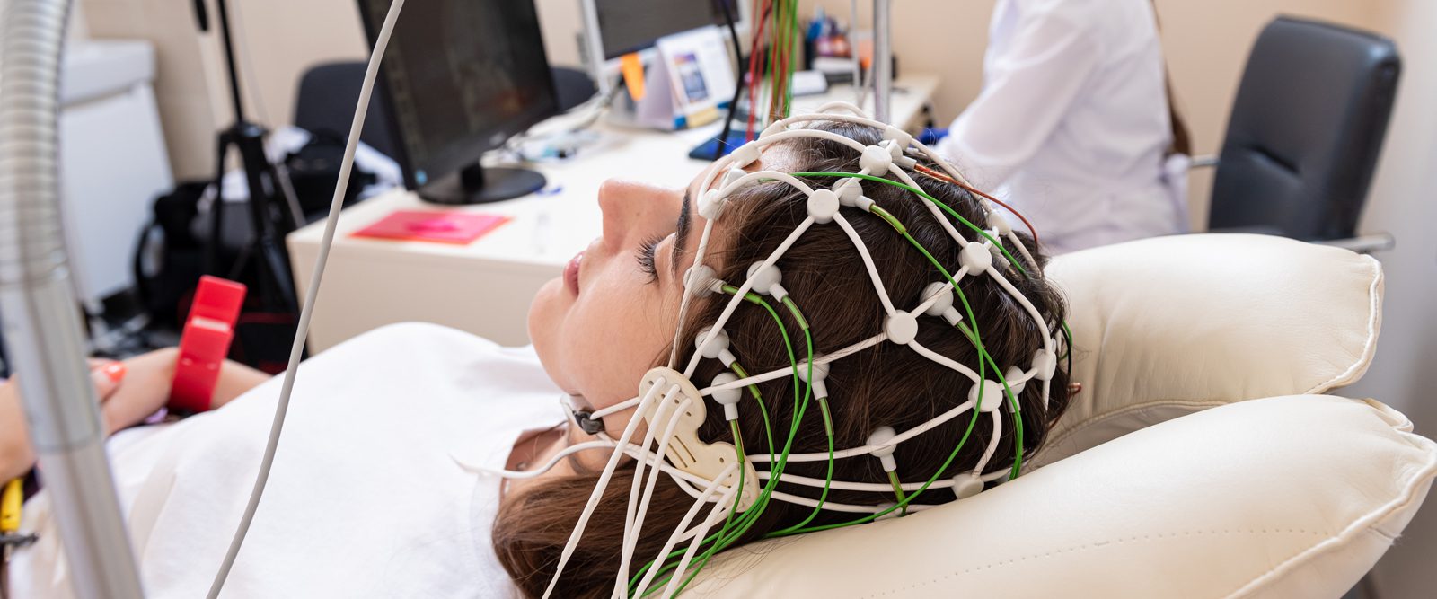 A young woman with electrodes on her scalp getting EEG readings for epilepsy.