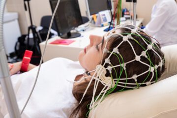 A young woman with electrodes on her scalp getting EEG readings for epilepsy.