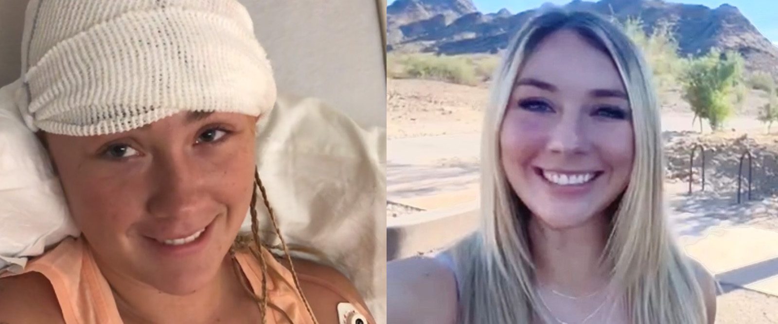 Gianna Spirio in the hospital after surgery and on a hike living life.