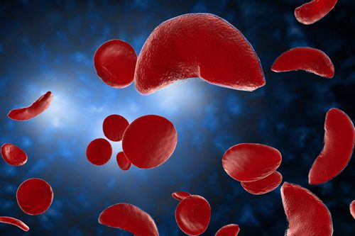 FDA Approves First Gene Therapies to Treat Sickle Cell Disease