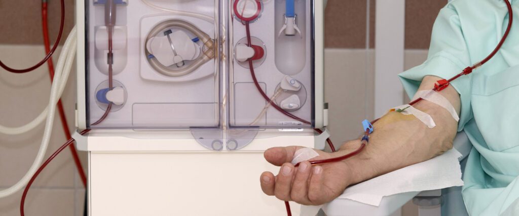 HOW DOES DIALYSIS WORK TYPES PROCESS AND WHAT TO EXPECT visual data 8