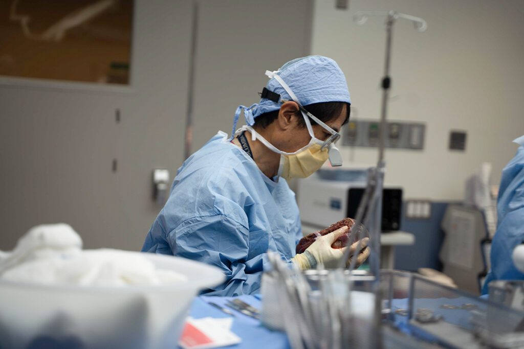 Dr. Tomoaki Kato,chief of transplant surgery at NewYork-Presbyterian/Columbia University Irving Medical Center, holding a portion of a liver as part of the first reported living donor domino split-liver transplant in adults in the United States.