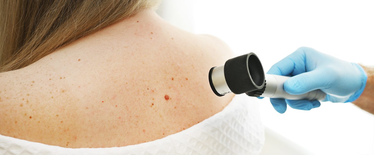 A doctor examining a mole on a woman's back
